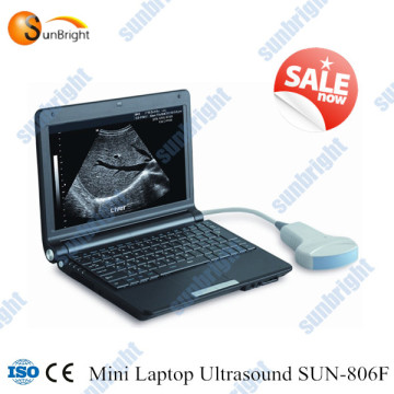 Medical equipment/digital portable ultrasound scanner