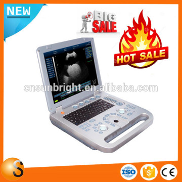 China 2015 New arrival veterinary ultrasound equipment /ultrasound veterinary