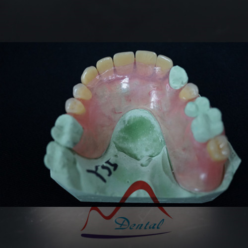 tcs® Flexible Partial Deture