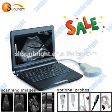 laptop type cardiac b ultrasonic