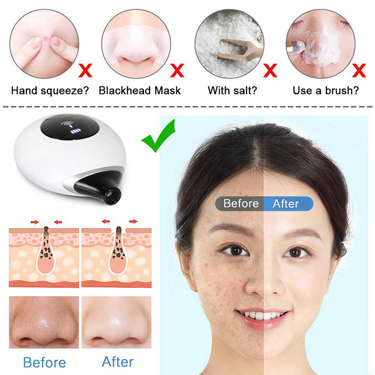 electric skin ice cool skin massager tool pore vacuum blackhead cleaner face lifting blackhead removing home SPA