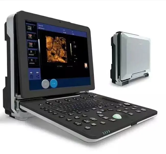 4D Color Ultrasound Doppler Probe Machine