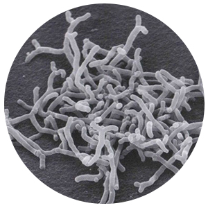 Bulk bifidobacterium longum probiotics powder improve digestive system