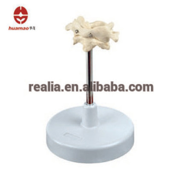 Spondyle Atlas and axis model