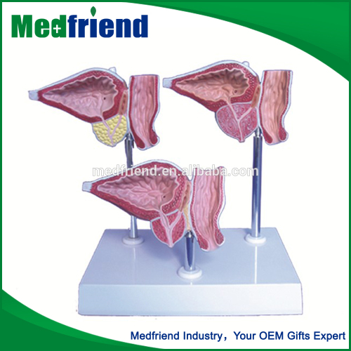 MFM010 Factory Price Prostate Glands Model