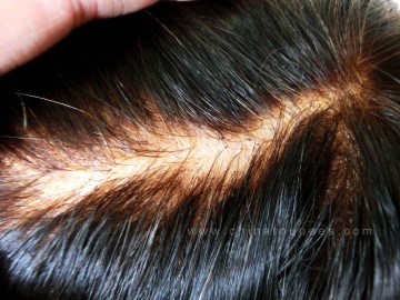 best quality ,hair toupee,nice bleached knot toupee