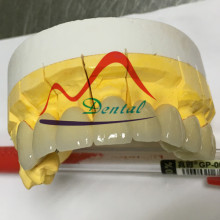 Half Arch Non precious PFM Bridge