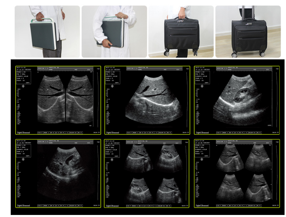 Tipo de labtura de ultra-som portátil Portable Ultrasound Labtop Type