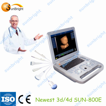 Digital medical ultrasound diagnostic equipment/laptop 3D ultrasound