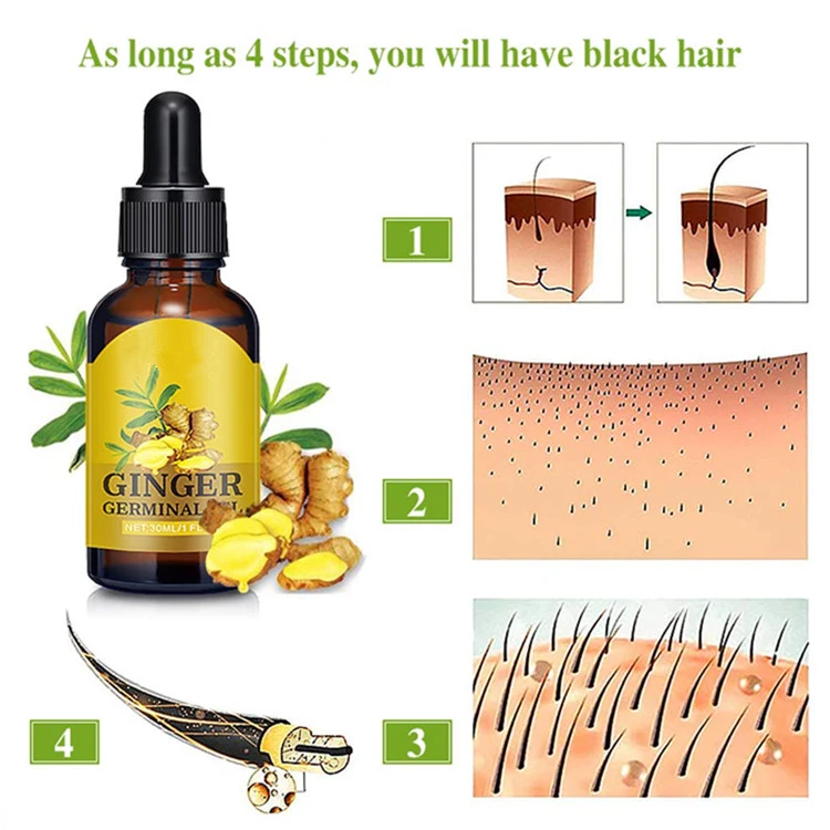 Wholesale Ginger Hair Growth Oil Hair Growth Repair Treatment Oil