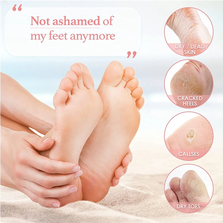 OEM Exfoliating Peeling Natural Treatment Cracked Heels Foot Peel Mask