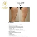 Fat Dissolvinglipolysis Injectionbody Slimming Lipo Lab Injection Fusion F-Xbc Lipolysis Injection Face Body C