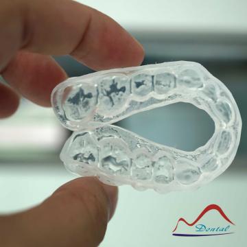 Dental Removable Bleaching Tray