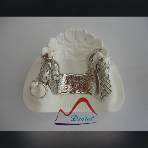 Vitallium framework  (1)