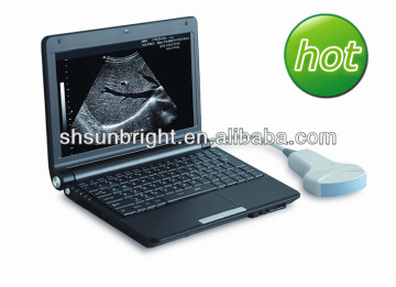 ultrasound scanner portable laptop