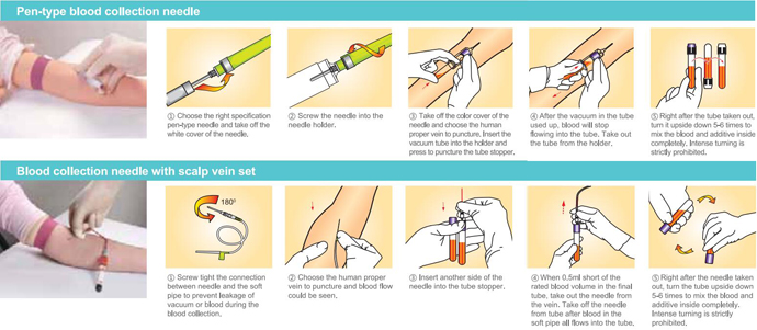 quá trình ống máu chân không process of vacuum blood tube