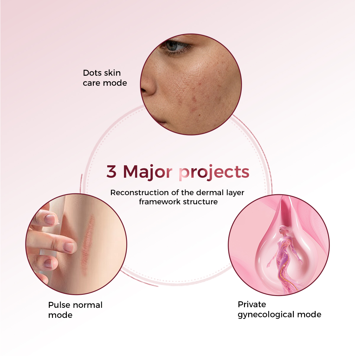 remoção de marcas de laser laser marks removal