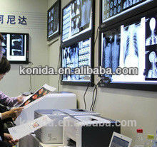 medical camera for hospital camera medical imager