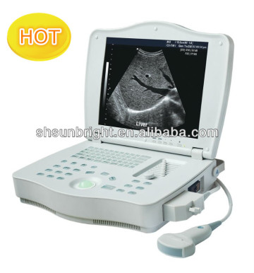 ultrasound scanner with linear probe