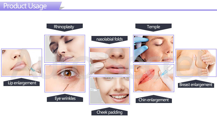 hyaluronic acid intra-articular injection