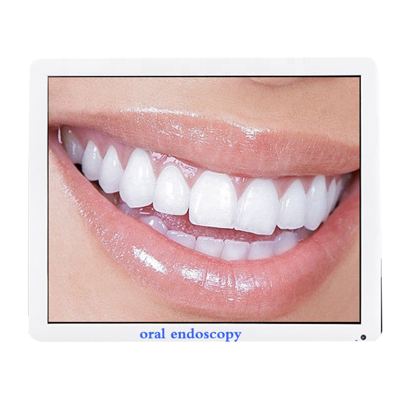 эндоскоп endoscope