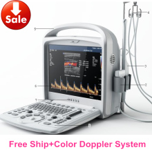 Human 2D Color Doppler Ultrasound Scanner with factory price