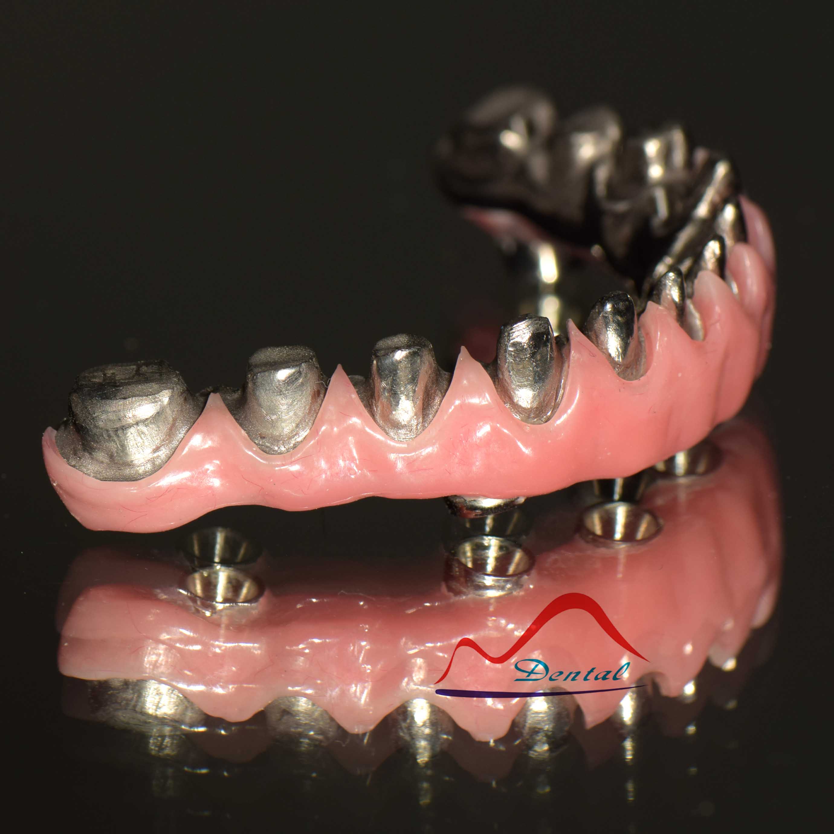 Screwed Implant Malo Bridge c