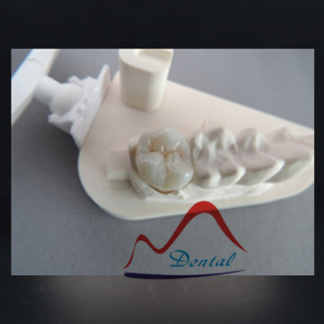 Dental Crown and Bridge in Full Zirconia