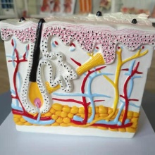 YA/HB013 Advanced Education Supplies Psoriasis Skin Model for Anatomical Teaching