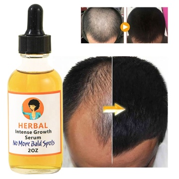 Private Label Organic Hair Growth Oil with DHT Blocker Vitamins