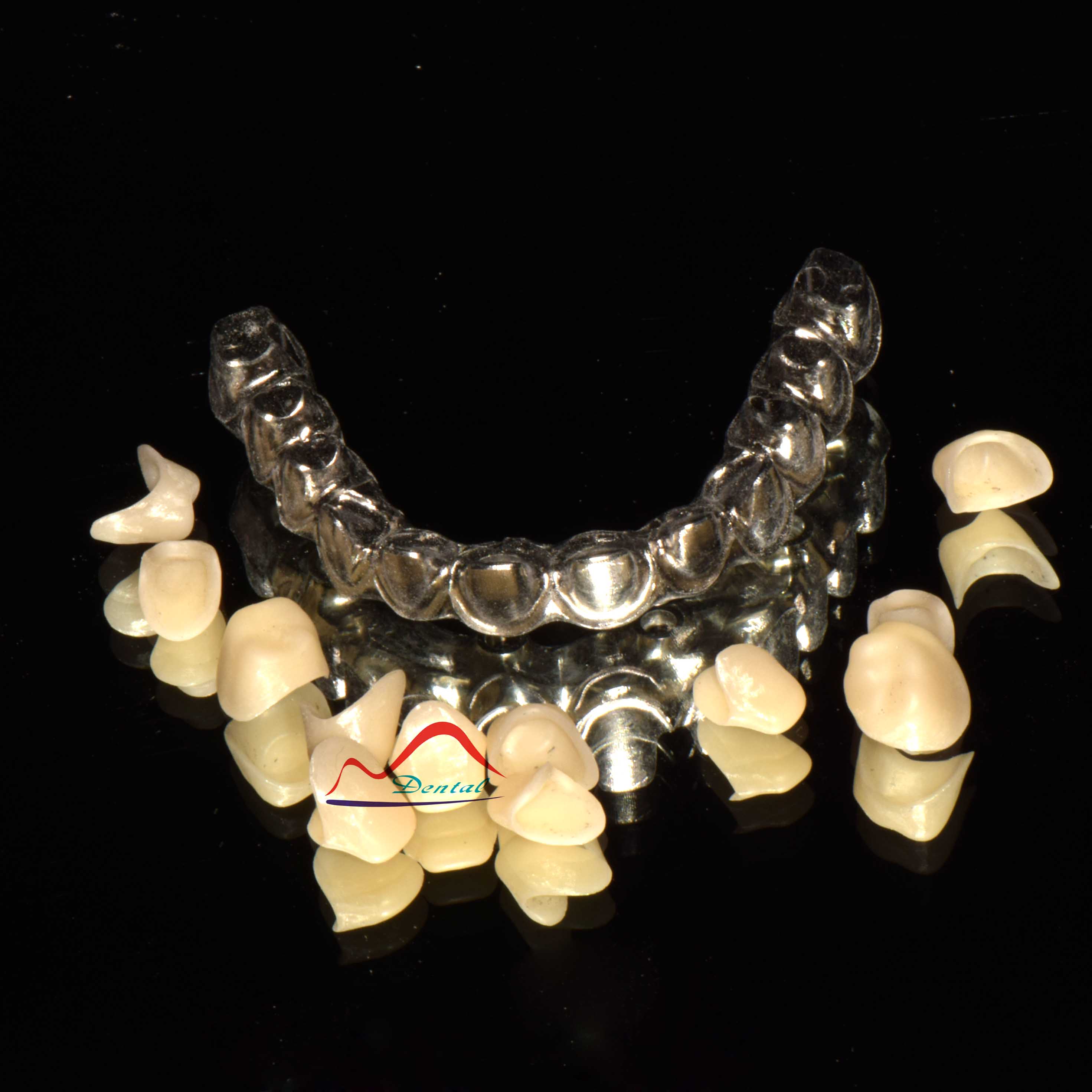 Screwed Implant Malo Bridge a