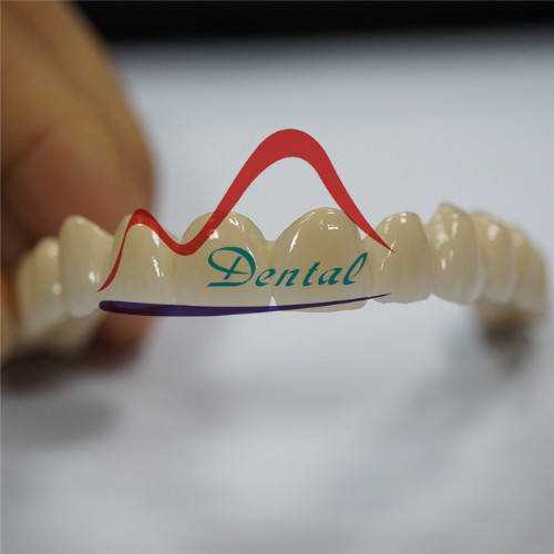 Co-Cr PFM Long Bridge with Translucenct Incisor