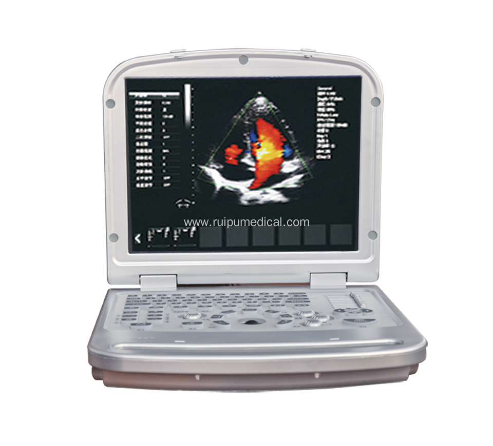 High Quality Laptop 4d Portable Color Doppler Ultrasound Machine