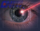 laser-ophthalmology