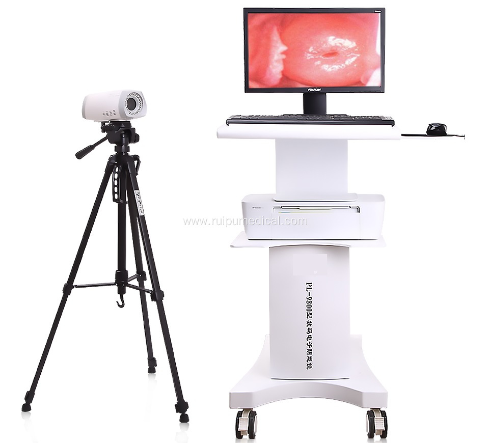 Medical Digital Portable Video Colposcope for Gynecology