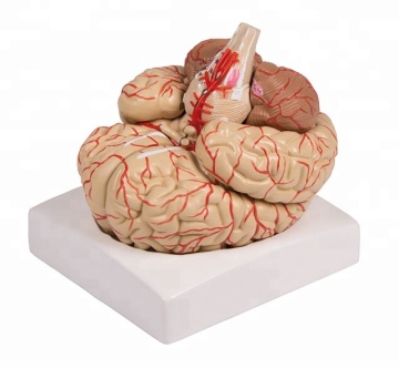 Human Plastic Brain with Arteries Anatomical Model