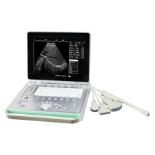 Portable Ultrasound Scanner machine Laptop ultrasound SS-7