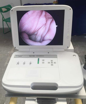 Ent surgery endoscope camera hospital equipment