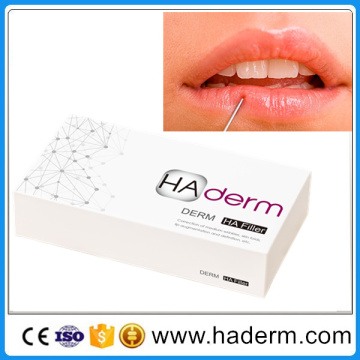 Injectable Hyaluronate Acid Dermal Filler for Lip Fullness Derm