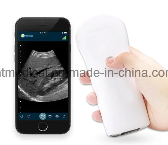 128 Elements Wireless Black and White Ultrasound Machine Scanner