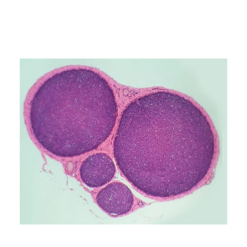 Histology Slides: Nerve Tissue Cell Structure View