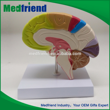 MFM002 Wholesale China Trade Anatomy Brain Model