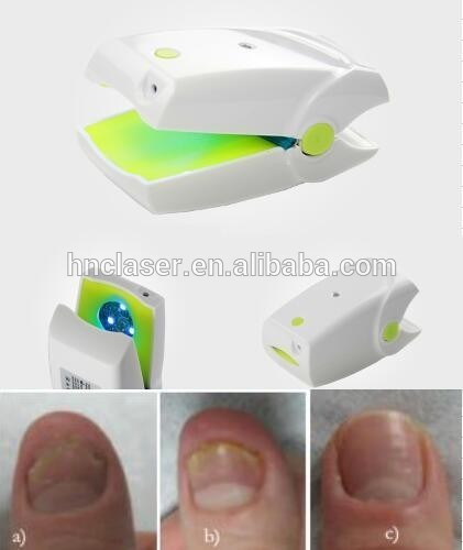 China OEM Fungal nail laser therapy device, infrared cold laser 905nm with 465nm blue light, looking for distributors