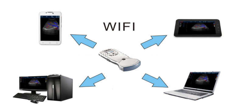 Convex Probe Color Ultrasound Imaging System