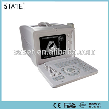 CRT display cheap ultrasound with great price