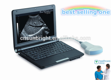 Portable ultrasounds/ultrasound equipment Medical Ultrasound