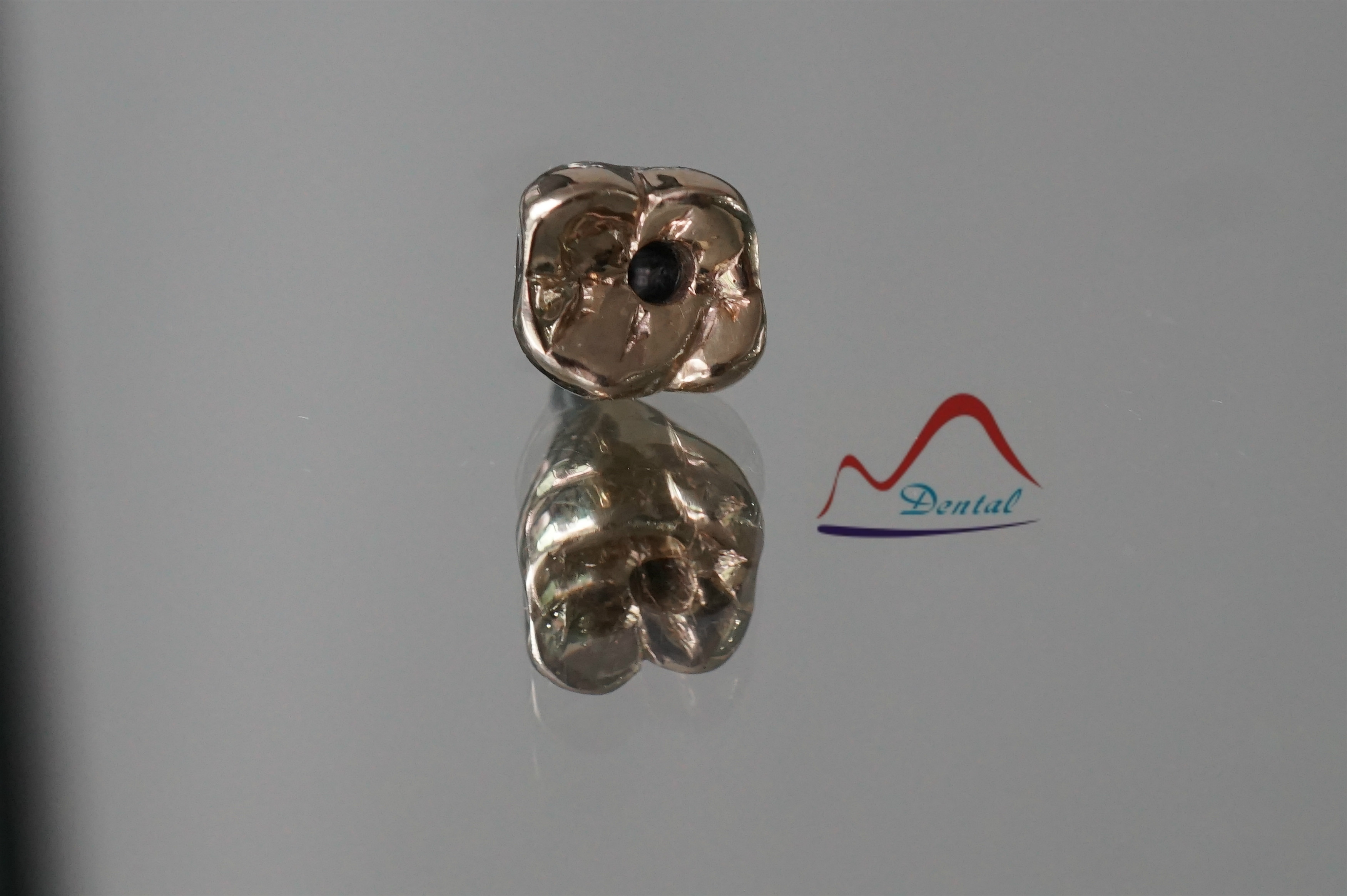 Implant full metal(1) Implant full metal(1)