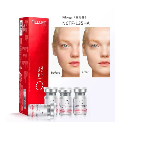 NCTF 135HA Dermal Filler Fillmed