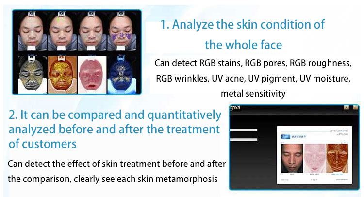 Skin Image Analyzer