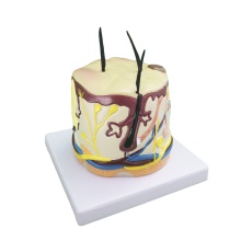 Human Acne Anatomic Medical Model Search Engine